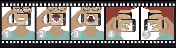 Smile assessment example